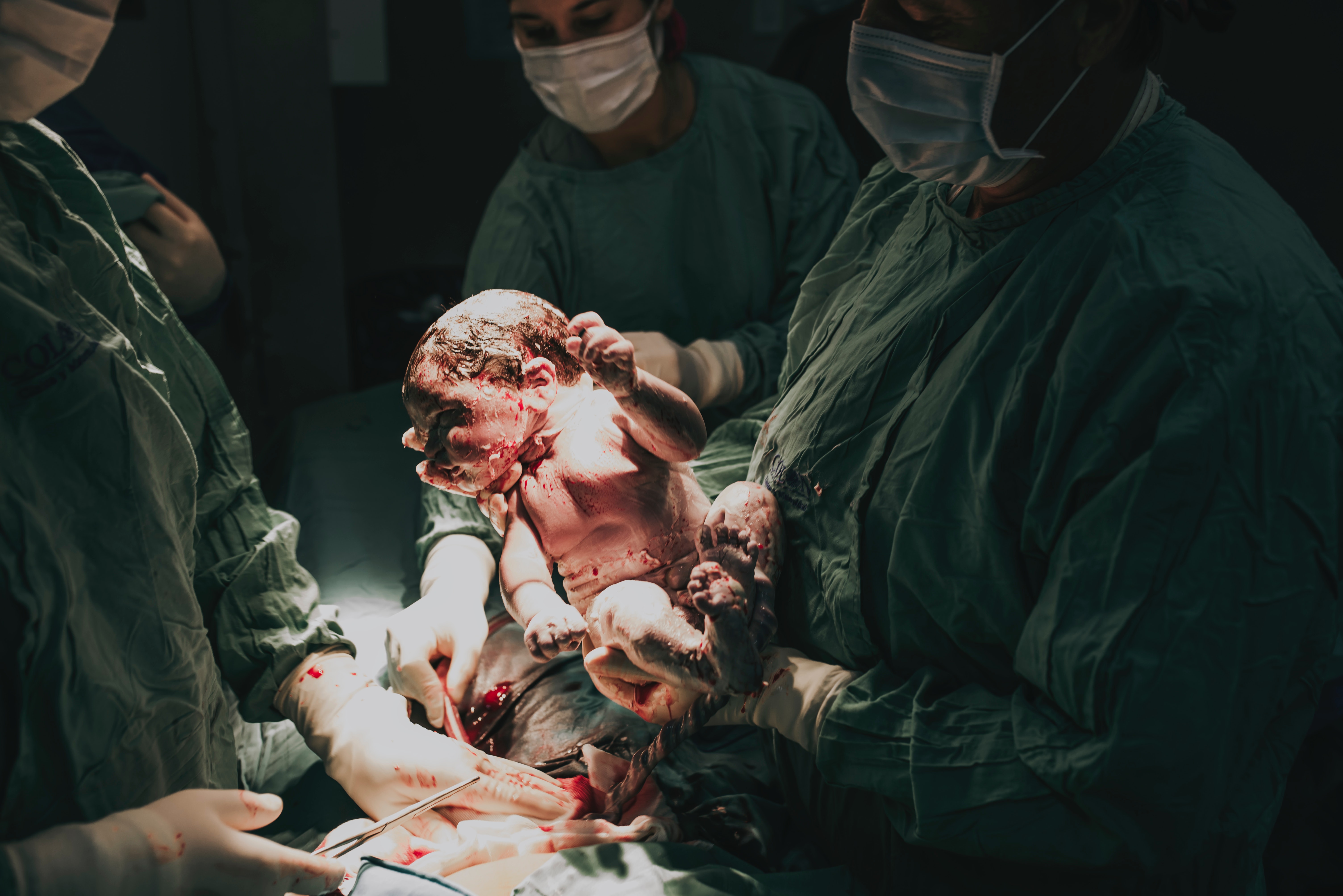 C Section